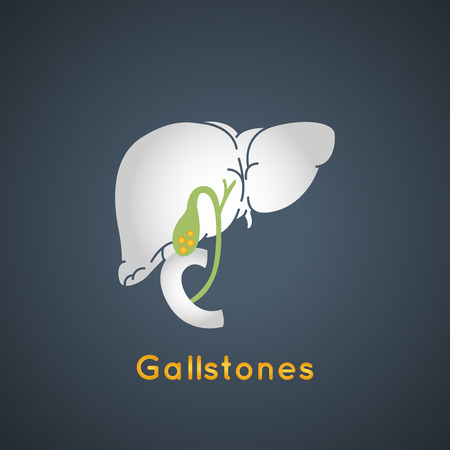 Gallstone vector logo icon illustrationのイラスト素材