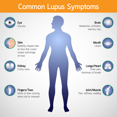 Common lupus symptoms vector icon illustrationのイラスト素材