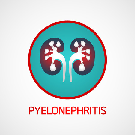 Pyelonephritis vector icon illustrationのイラスト素材