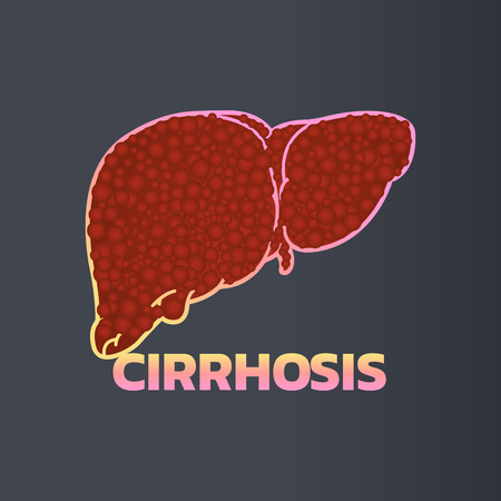 A cirrhosis icon design, infographic health, medical infographic. Vector illustrationのイラスト素材