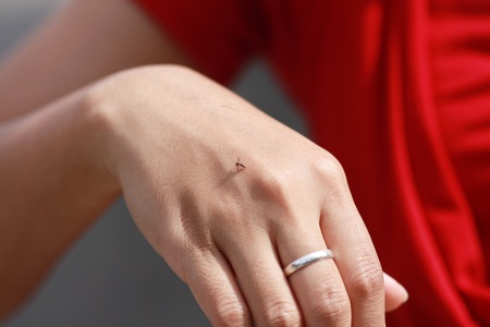 mosquito biting woman's handの写真素材