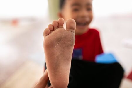 Asian boy showing dirty feet.の写真素材