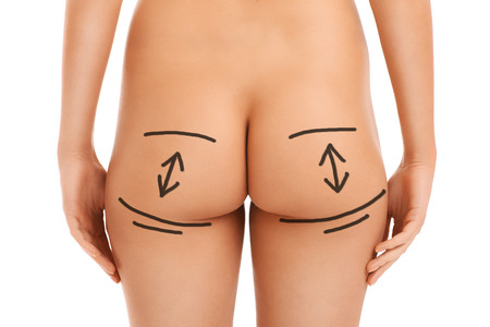 A picture of a female butt with surgery markers isolated over white backgroundの写真素材