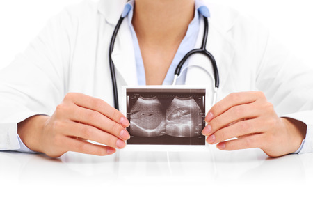 A midsection of a doctor holding ultrasound scan over white backgroundの写真素材