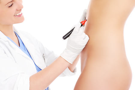 A picture of a doctor marking abdomen for plastic surgeryの写真素材