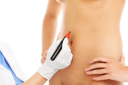 A picture of a doctor marking belly for surgeryの写真素材