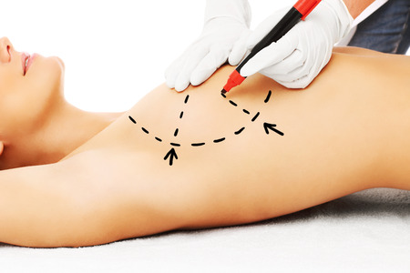 A picture of a doctor marking breast for surgeryの写真素材