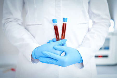 Woman holding test tube with blood and mixing machine