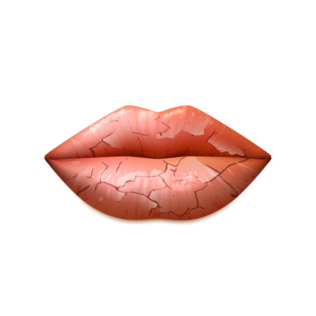 Dry cracked woman lips in a classic shape realistic isolated vector illustrationのイラスト素材