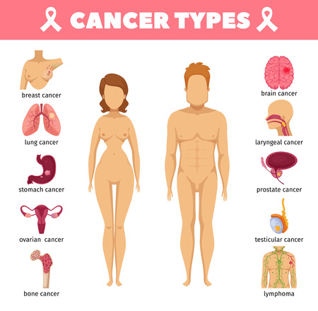 Cancer types set with breast lung stomach ovarian bone brain prostate testicular laryngeal isolated icons flat vector illustrationのイラスト素材