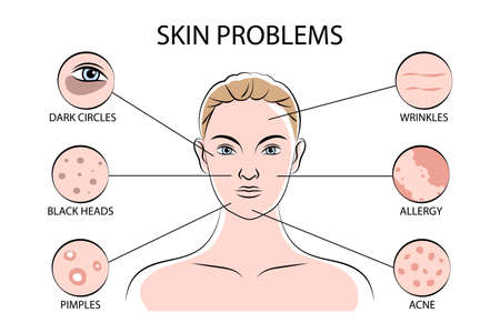 Skin Problems Infographicsのイラスト素材