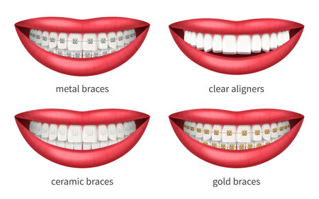 Teeth Braces Setのイラスト素材