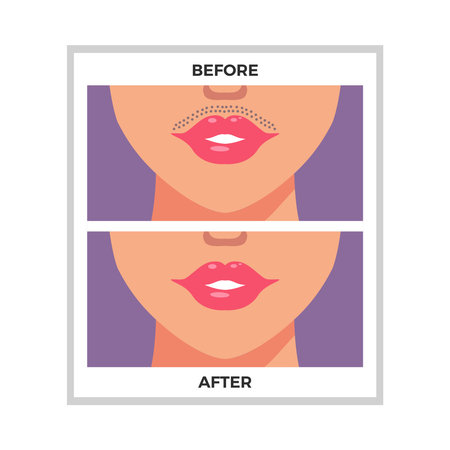 Flat Hair Removalのイラスト素材