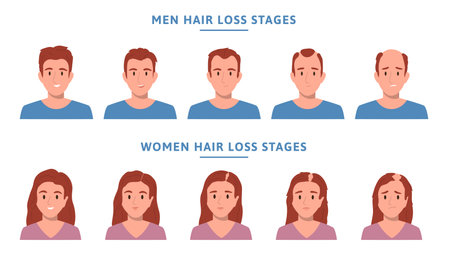 Hair Loss Alopecia People Flat Icon Setのイラスト素材