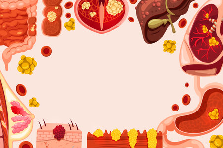 A background shows stylised liver kidney colon organ icons tumor cell clusters and red blood cells on a pale background in flat cartoon styleのイラスト素材