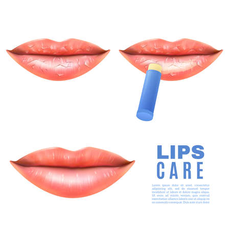 Lip care balsam for moisturizing treatment of chapped dry and sensitive lips white background poster realistic vector illustrationのイラスト素材