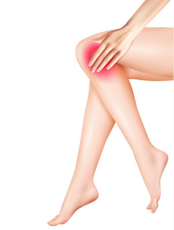 Female legs and pain with knee pain symbols vector realistic illustrationのイラスト素材