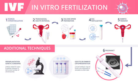 Colored in vitro fertilization IVF flat infographics with steps of additional techniques vector illustrationのイラスト素材