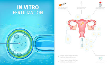 Flat in vitro fertilization process composition with female reproductive system fertilized egg development medical tools for artificial insemination vector illustrationのイラスト素材