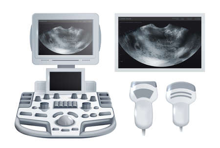 Medical ultrasonography checkup equipment with transducers and monochrome snapshots realistic design concept isolated vector illustrationのイラスト素材