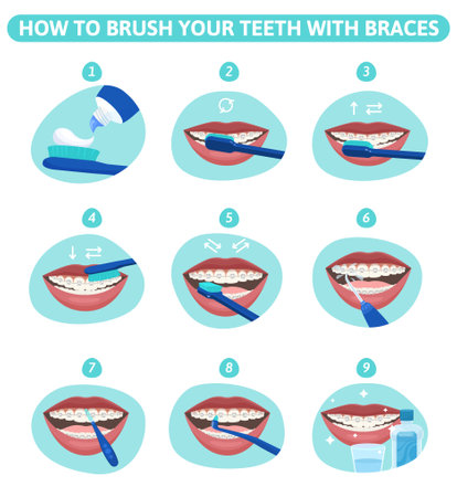 Dental hygiene flat set of round infographic compositions showing mouth stages of teeth cleanup with braces vector illustrationのイラスト素材