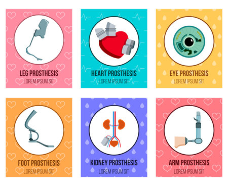 Orthopedic medical prothesis flat cards collection with artificial kidney eye implants and prosthetic limbs isolated vector illustrationのイラスト素材