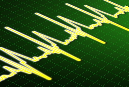 ECG - Heartbeat impulse line の写真素材
