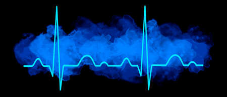 Electrocardiogram graphic in vector quality.