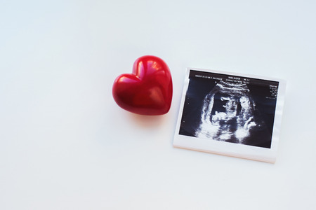 Red heart on a white background, and next to it a picture ultrasoundの写真素材