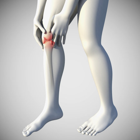 This 3d illustration shows the knee pain condition in side viewの写真素材