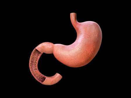 stomach, anatomy detail, illustration of a human stomach, renderingの写真素材