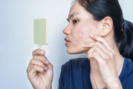 Close-up portrait of a worried young Asian woman in front of small mirror with on white background. Skin problem of pimple, Teenager checking, pointing and touching face by fingers. Skincare concept.の写真素材