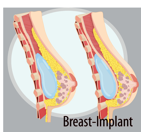 Vector illustration of Breast anatomyのイラスト素材