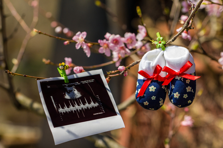 Baby slippers and ultrasound image hanging on a branch of blossoming treeの写真素材