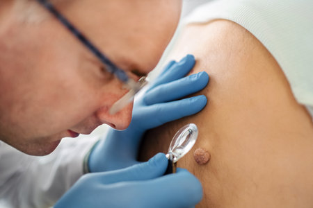 Dermatologist carefully inspects skin lesion during checkupの写真素材