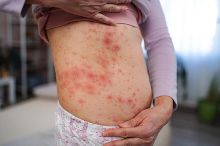 Person suffering from painful rash on body skin
