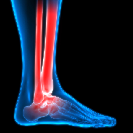 Human Body Bone Joint Pains (Foot joints and Bones)の写真素材