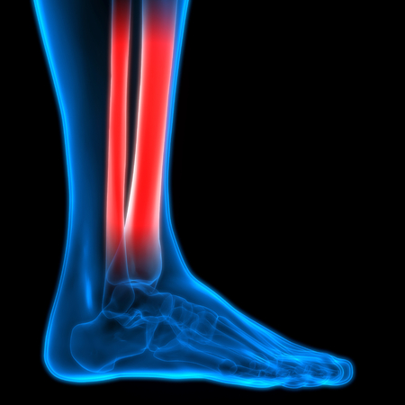 Human Body Bone Joint Pains (Foot joints and Bones)