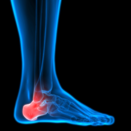 Human Body Bone Joint Pains (Foot joints and Bones)の写真素材