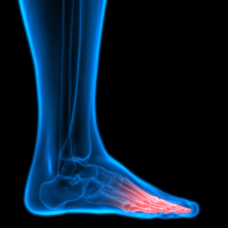 Human Body Bone Joint Pains (Foot joints and Bones)の写真素材