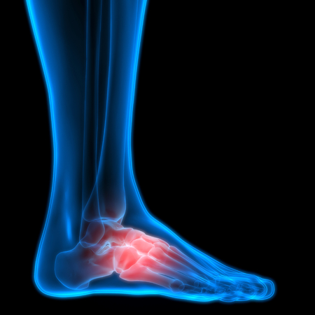 Human Body Bone Joint Pains (Foot joints and Bones)の写真素材