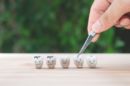 Dentist use tweezers to set of decayed tooth model for dental health care concept