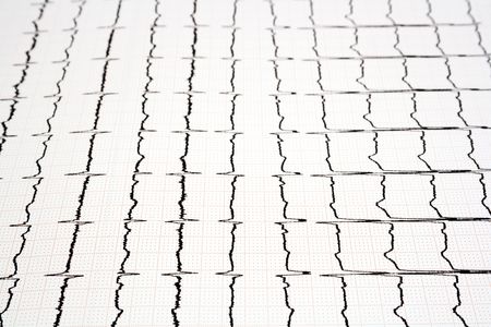 Close-up image of ECG - EKG graphの写真素材