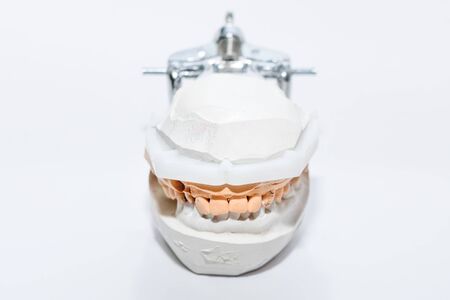 Plaster Cast of jaws. Dental casting gypsum model human Jaws in prosthetic laboratory. Dentistry,...