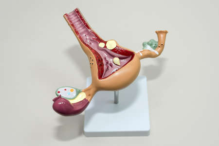 A model of the reproductive system of women. Anatomical model of uterus with ovaries. The concept of...