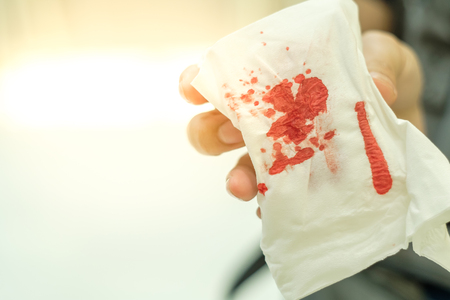 Blood on gauze use to stop bleedingの写真素材