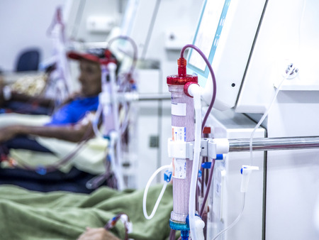 Hemodialysis in people on the equipmentの写真素材