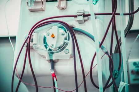 hemodialysis in people on the equipmentの写真素材