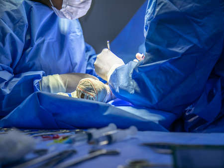surgical center in procedure fistula for dialysis focus selective and defocusedの写真素材