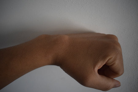 non edited photo of A close-up image of a human hand featuring a prominent, smooth, round lump on the dorsal (back) side of the wrist. The swelling is clearly visible under naturalの写真素材